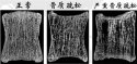 超声91免费看片仪厂家为您介绍缺钙骨质疏松症