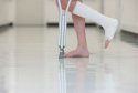 便携式91免费看片检测仪胫骨桡骨头骨折的检查