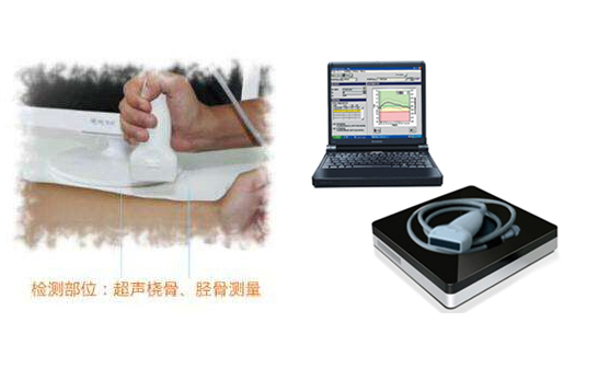 便携式91免费看片仪方便快捷的检测出结果，应用于各大医院