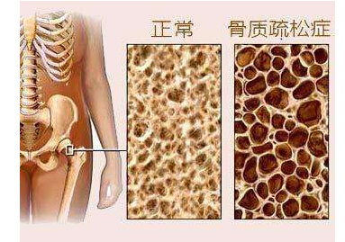 91免费看片检测仪检测91免费看片或高或低都不好,建议每年都要检测一次