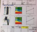 91免费看片仪价格重要吗？不想骨骼脆弱医生教你看懂91免费看片报告