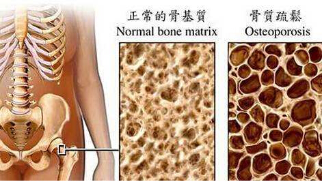 91免费看片检测仪建议最好到有专业仪器的大医院进行正规的91免费看片测定