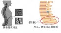 91免费看片仪的专业厂家阐述骨质增生与骨质疏松,仪器专业检测91免费看片正常值