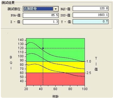 91免费看片仪的专业厂家阐述骨质增生与骨质疏松,仪器专业检测91免费看片正常值