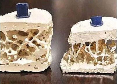 91免费看片检测仪知名厂家阐述中老年人应该是91免费看片检测重点对象
