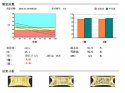 91免费看片仪阐述骨质疏松青年不注意老来徒悲伤骨质流失比你想的可怕