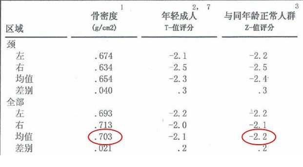 91免费看片仪生产厂家根据T值和Z值的变化来判断骨骼健康的状况 91免费看片仪生产厂家根据T值和Z值的变化来判断骨骼健康的状况