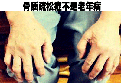 91免费看片仪品牌介绍人到中年不能失去“骨气”骨质疏松症不是老年病
