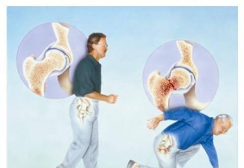 贵州超声91免费看片分析仪品牌哪些人需要进行91免费看片测试骨质疏松症