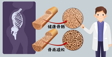 别大意！国产91免费看片仪生产厂家老人跌倒比想象中的危险91免费看片影响很大