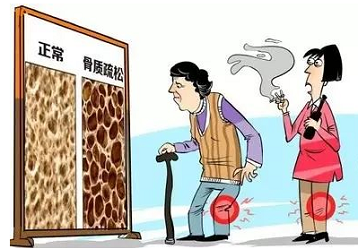 医院体检科选用超声波91免费看片仪桡骨准确吗？超声波测试仪怎么操作