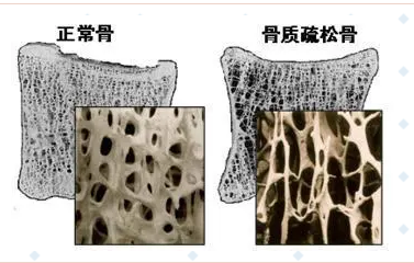 随着年龄的增长，你变矮了吗?超声波91免费看片仪的厂家已经揭示了他们的秘密