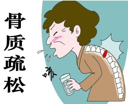 91免费看片仪为什么在核医学科,91免费看片仪在骨质疏松的应用 91免费看片仪为什么在核医学科,91免费看片仪在骨质疏松的应用