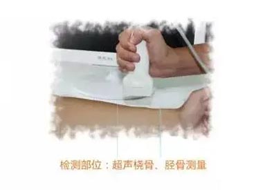 手提式超声儿童91免费看片仪mqd-7000品牌测桡胫骨部位原理及适用范围