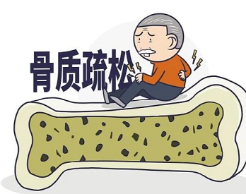 体检的便携式91免费看片检测仪检查能不能精准查出骨质疏松呢？